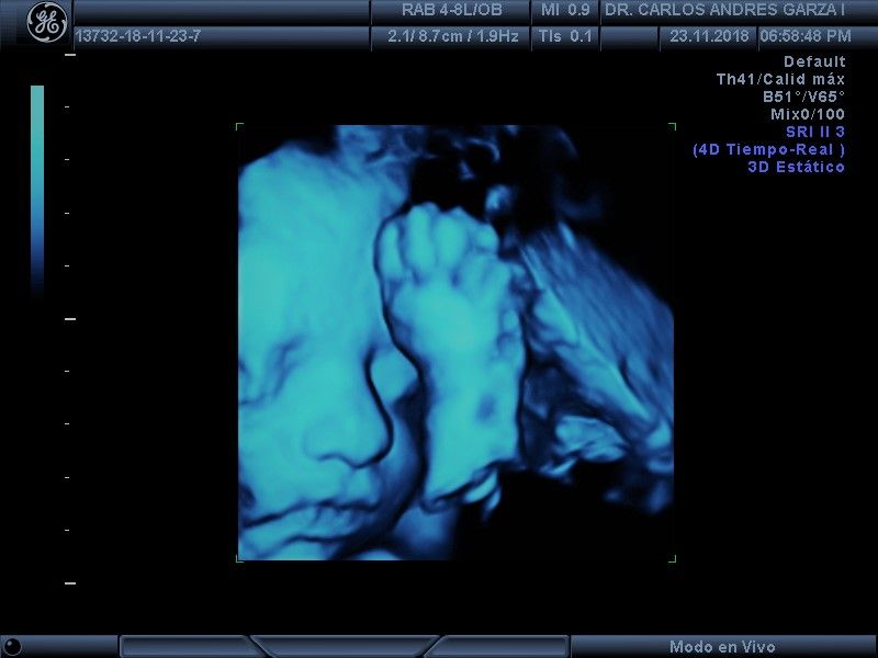 Carlos Andrés Garza Flores-2