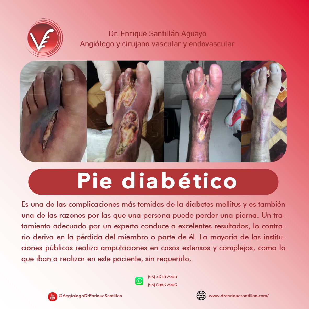 Enrique Santillán Aguayo-10