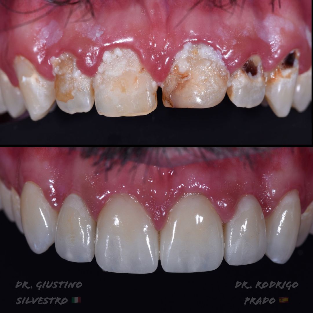 Giustino Silvestro-2