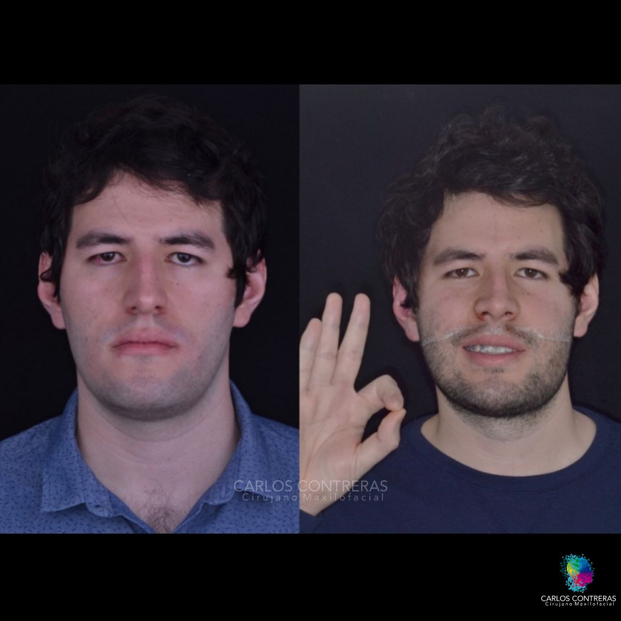 Carlos Ernesto Contreras Castellanos-31