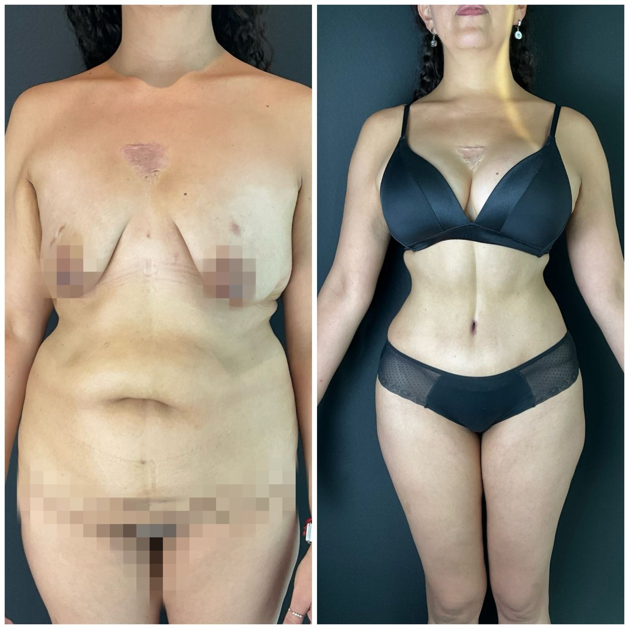 Giuseppe Tanzillo-11