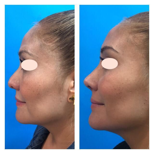 Carola Berenice Curiel Davalos-29