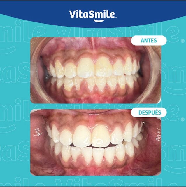 Genesis Johanna Cazares Valles-3