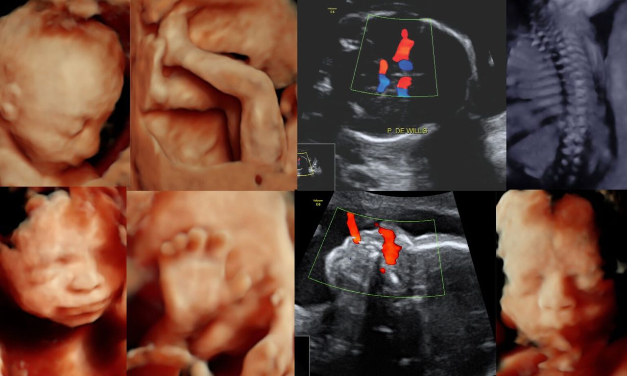 Jose Andres Burgos Zuleta-7