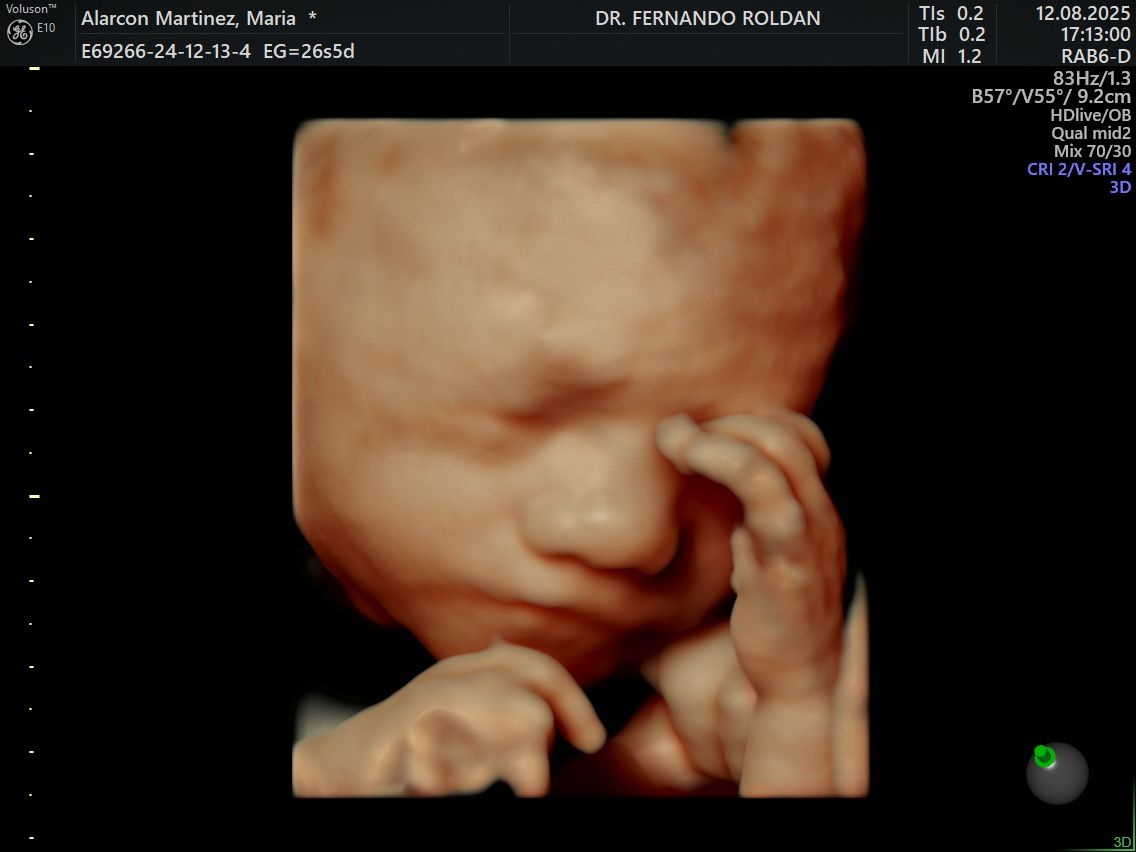 Fernando Roldan Arce-4