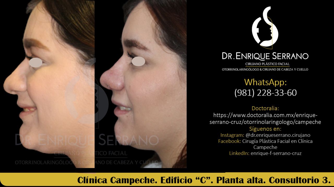 Enrique Serrano Cruz-72