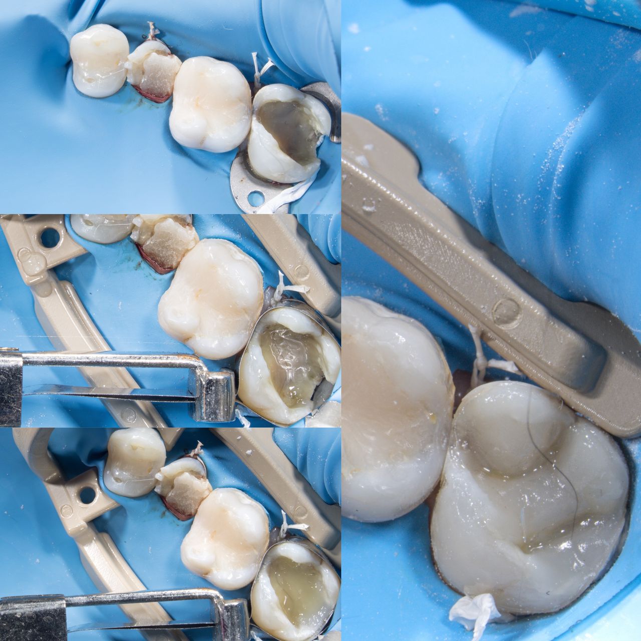 Hervin Eduardo Mendez Borrego-23