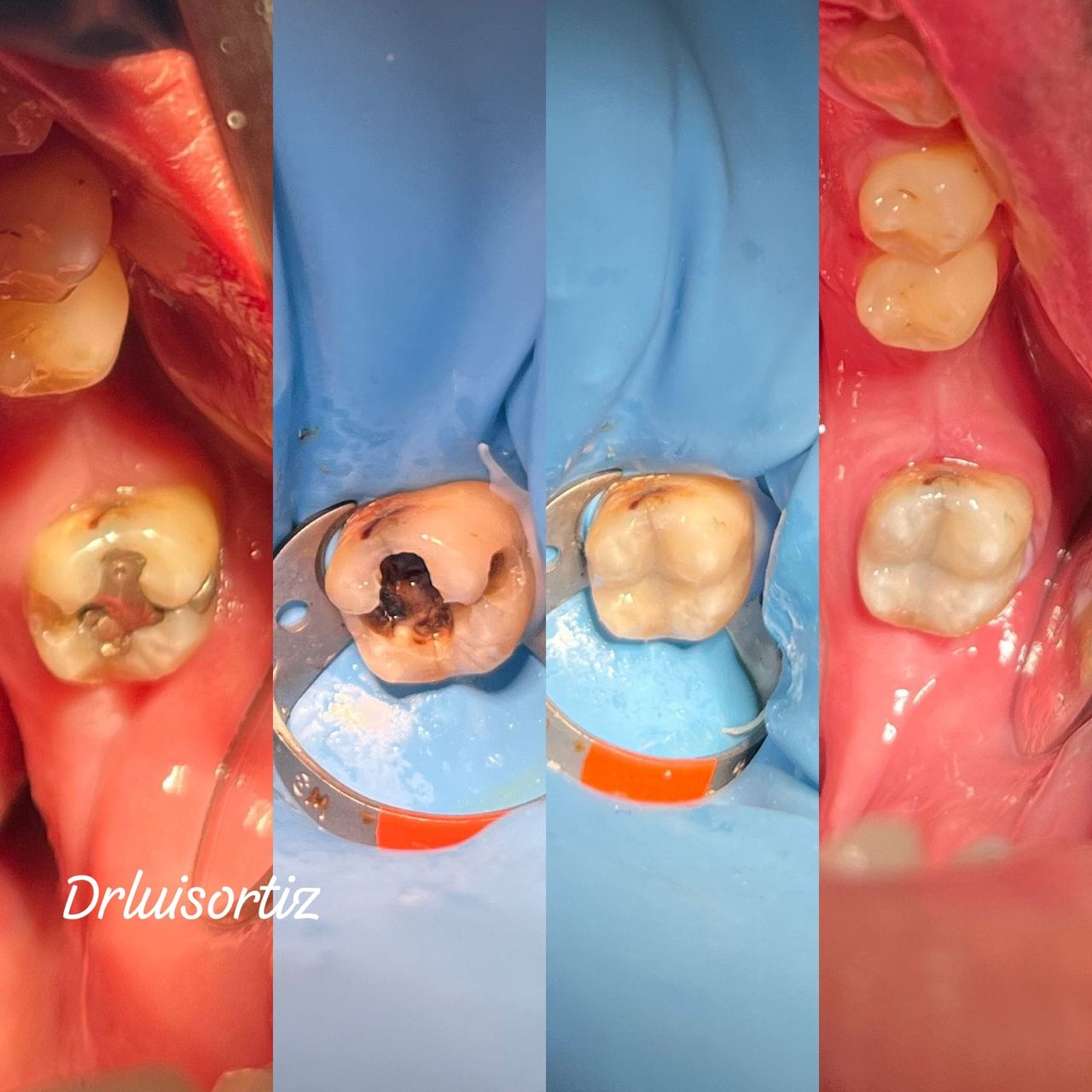 Luis Ángel Ortiz López-36