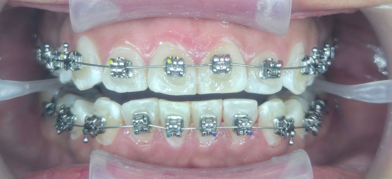 Edgardo Caballero Dávila-13