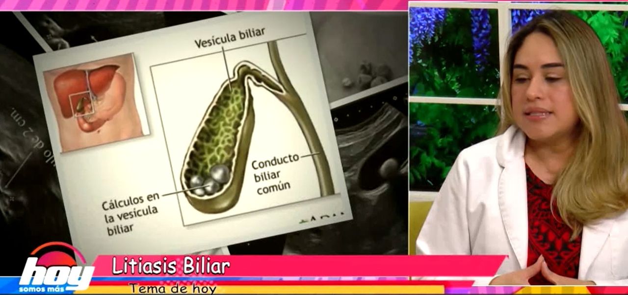 Mary Yeyzel Ortega Aranda-24