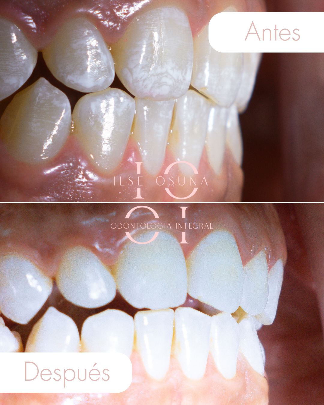 Ilse Valeria Osuna Rodríguez-12