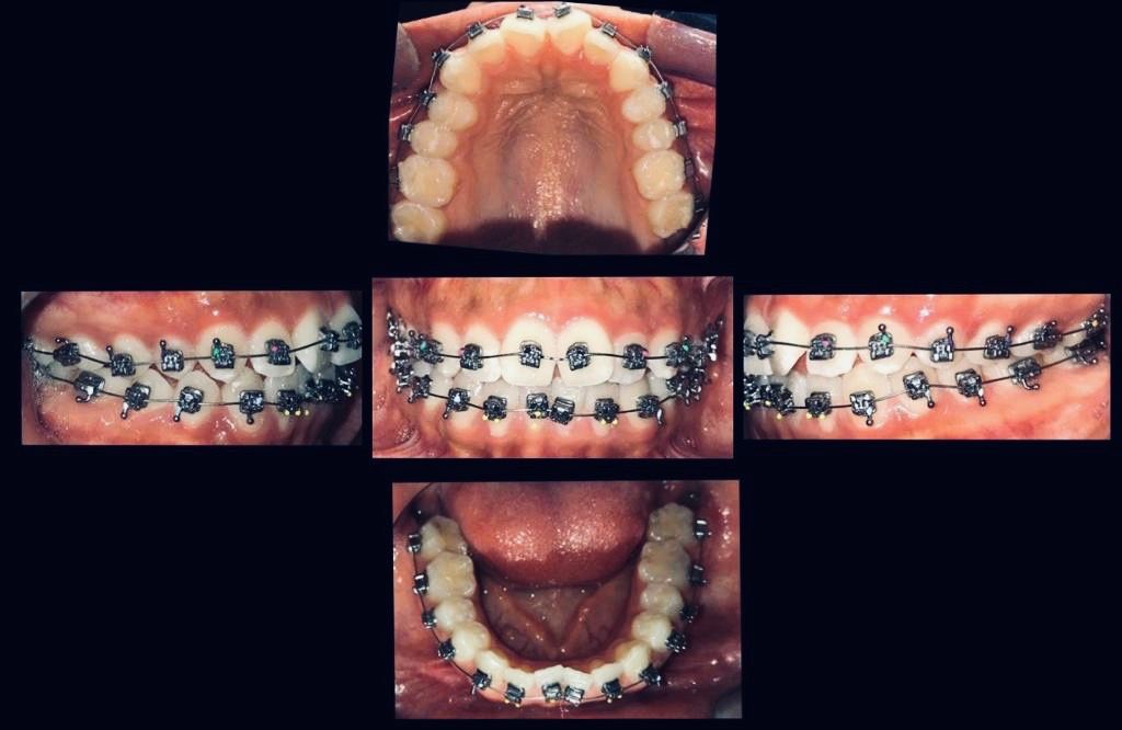 Zuriel Ayala Garcia-10