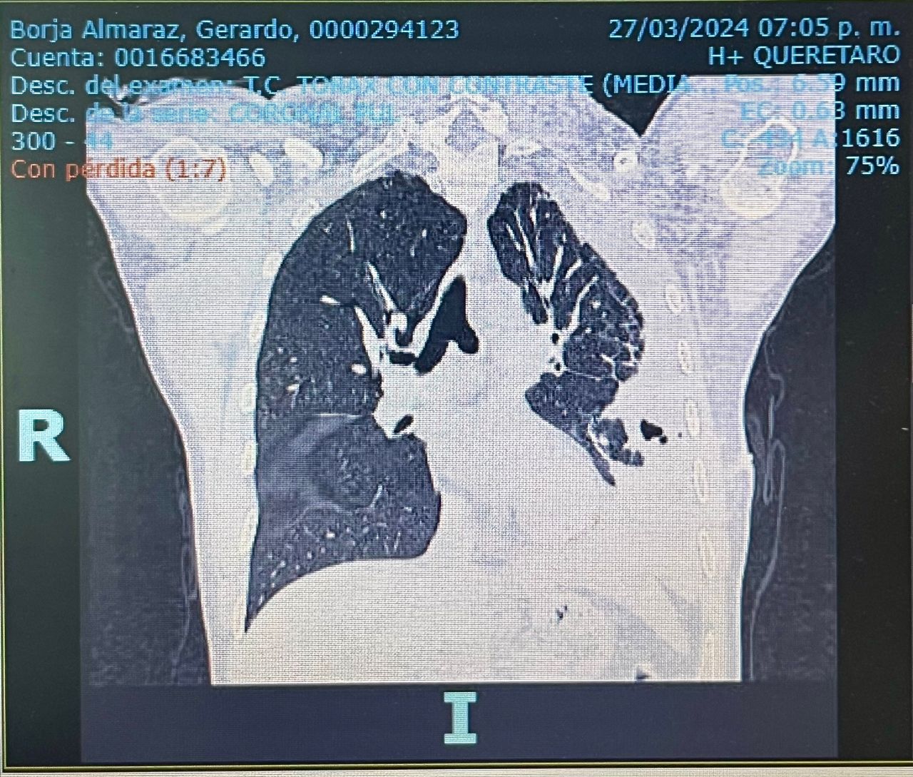 Rogelio Hernández García-95