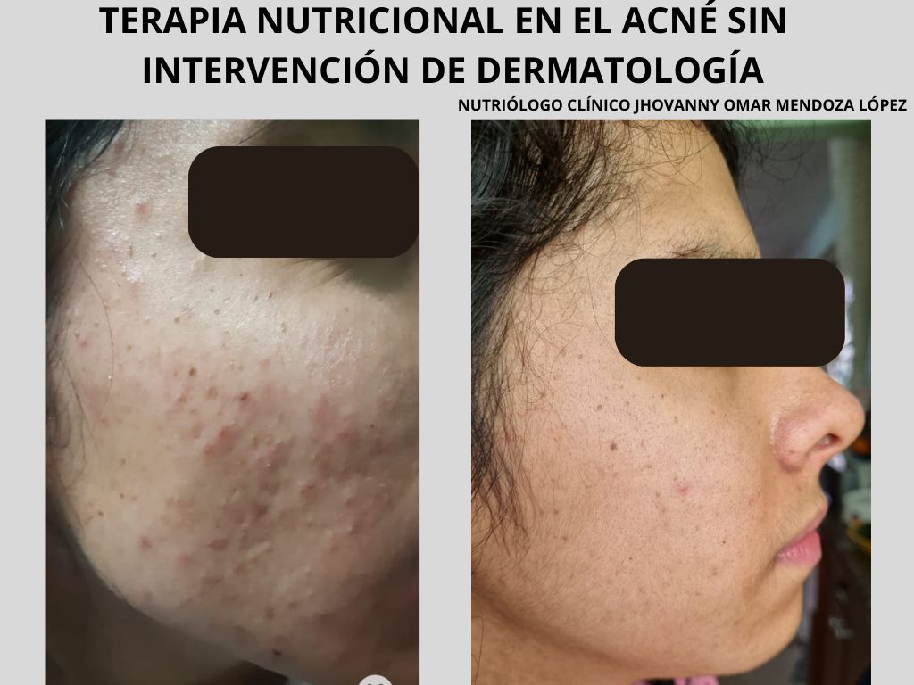 Jhovanny Omar Mendoza López-1