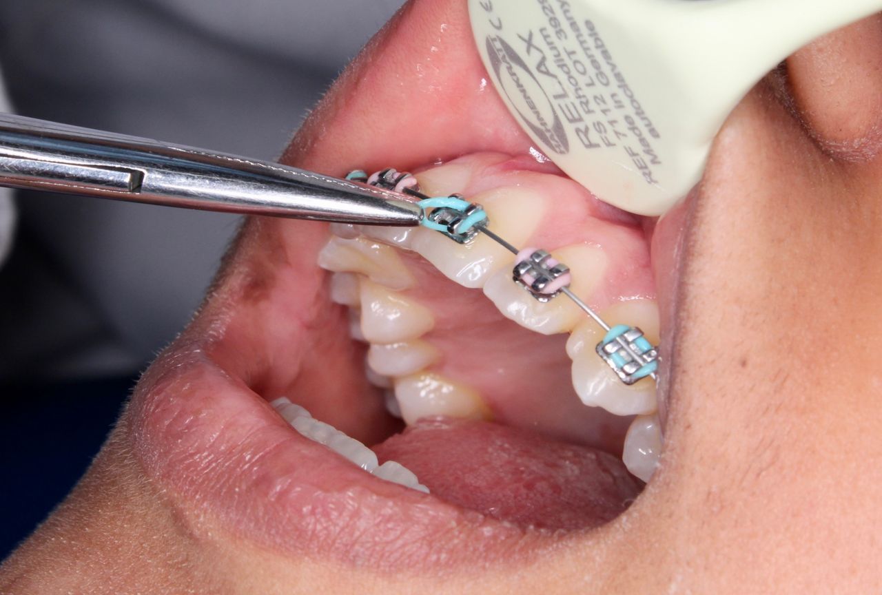 Bielmy Veronica Jonapa Peña-36