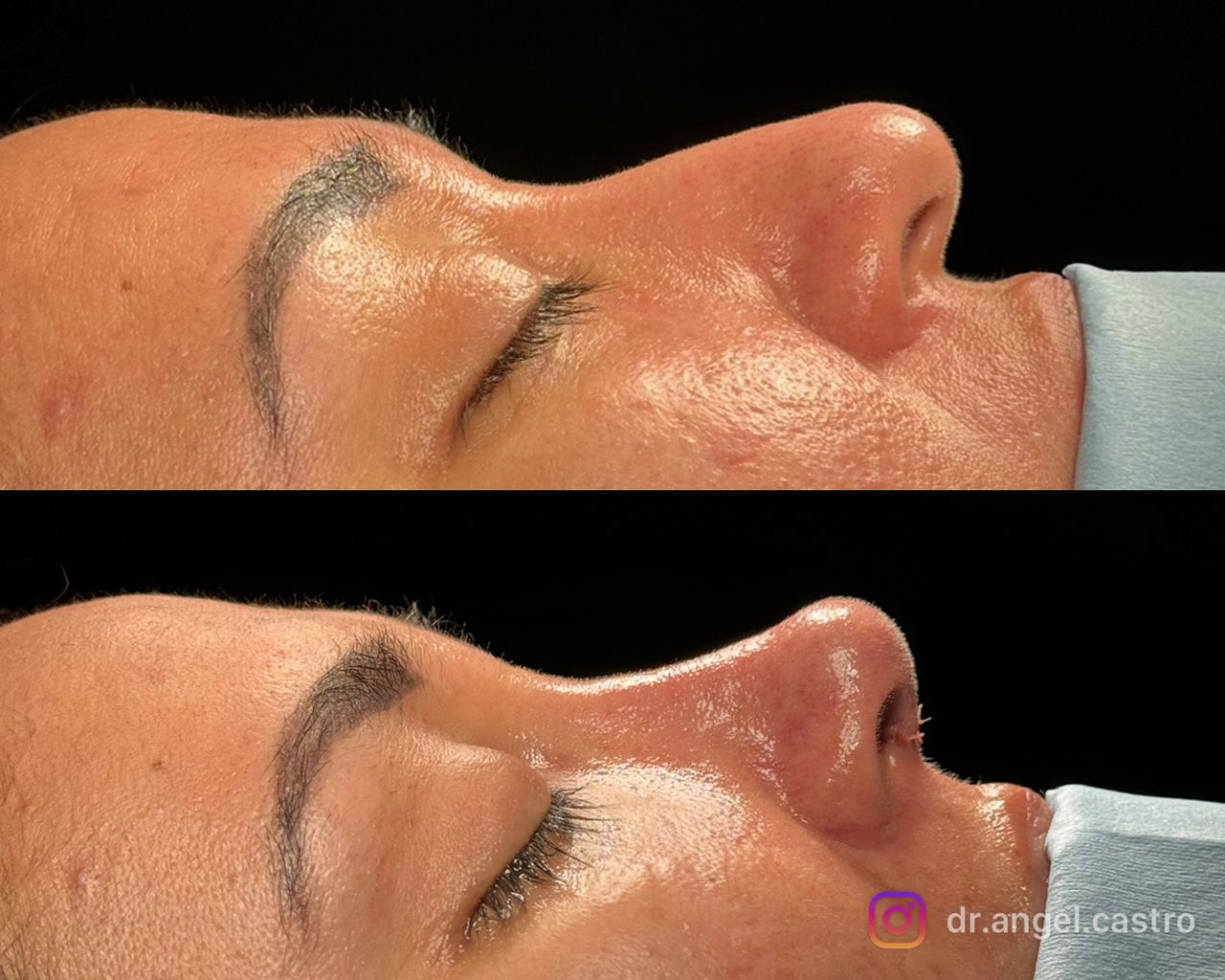 Angel Castro Urquizo-81