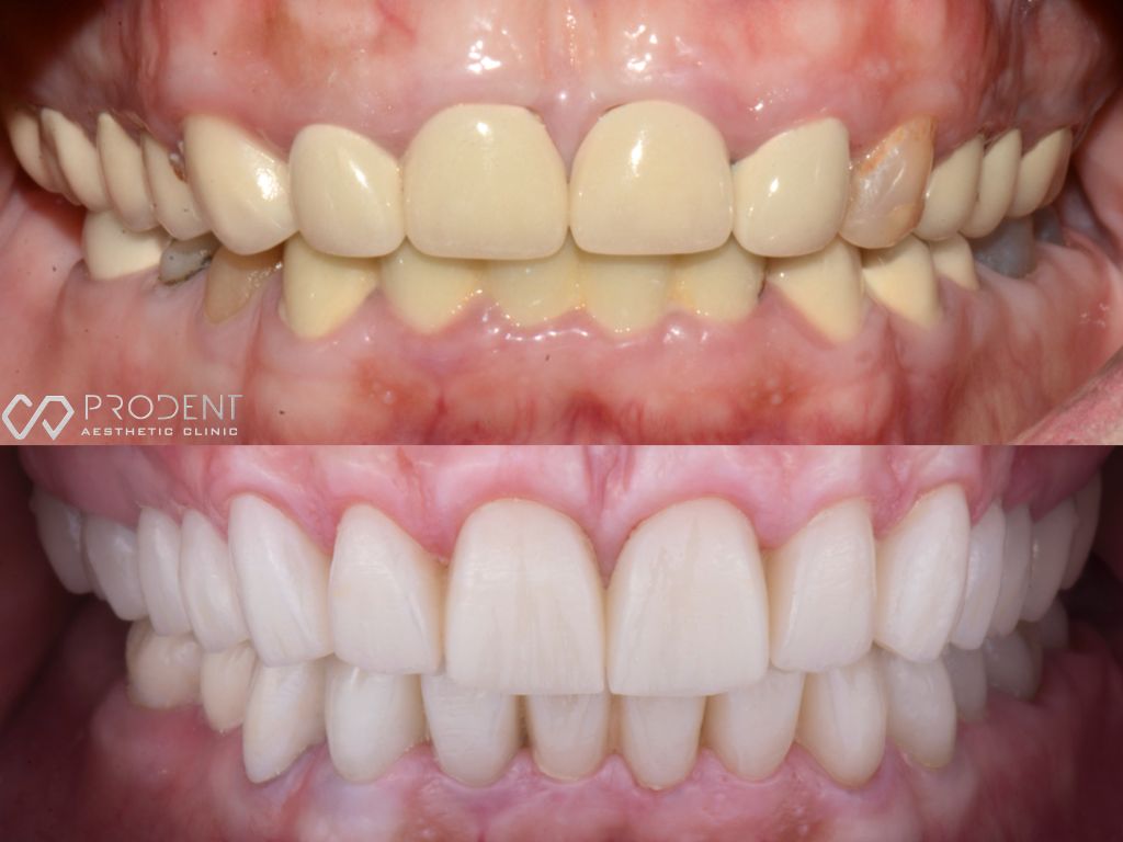 Ulises Pérez Murillo-43