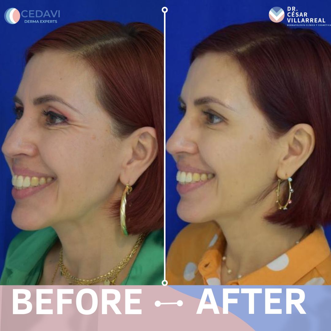 César Daniel Villarreal Villarreal-10