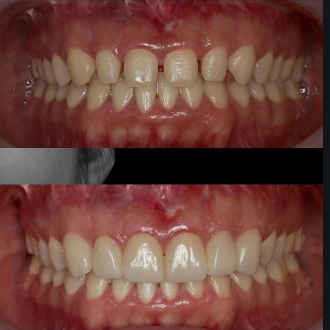 Lilly Bentriz Sifuentes-1