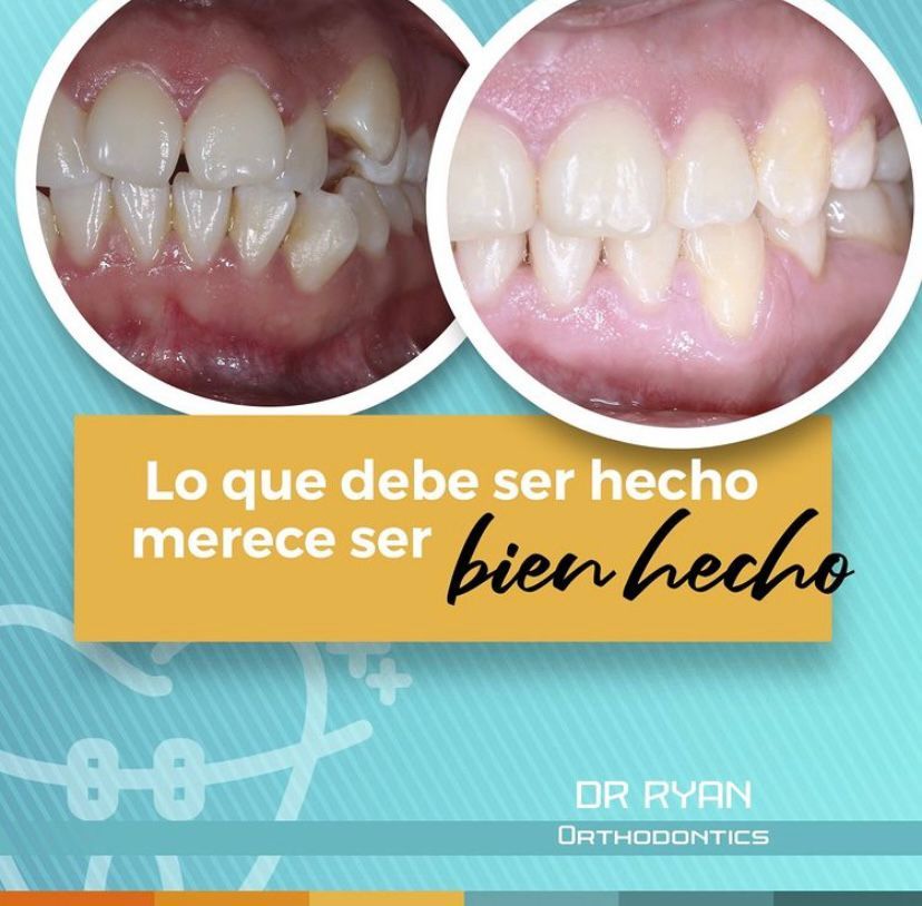 Ryan Michael Brenes Pacheco-10