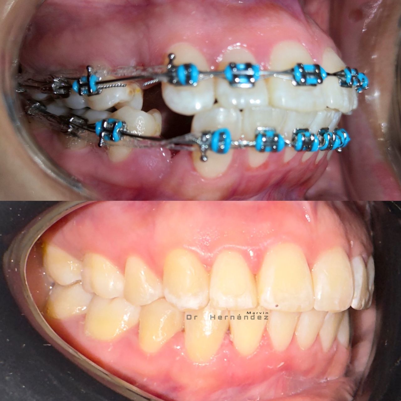 Marvin Adair Hernández Álvarez-22