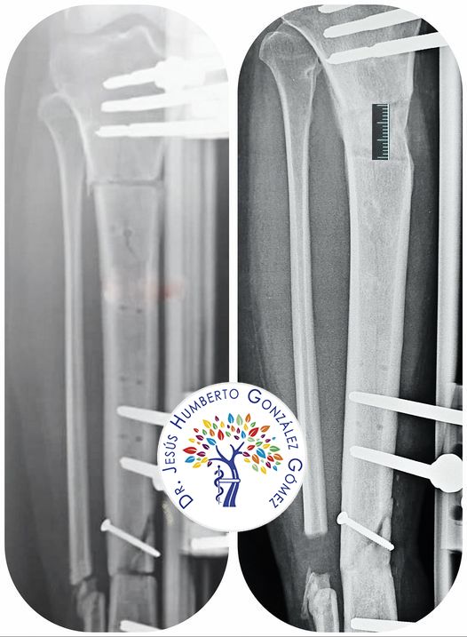 Jesús Humberto González Gómez-25