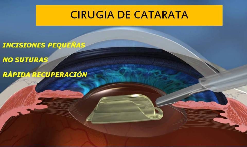 Armando Capote Cabrera-2