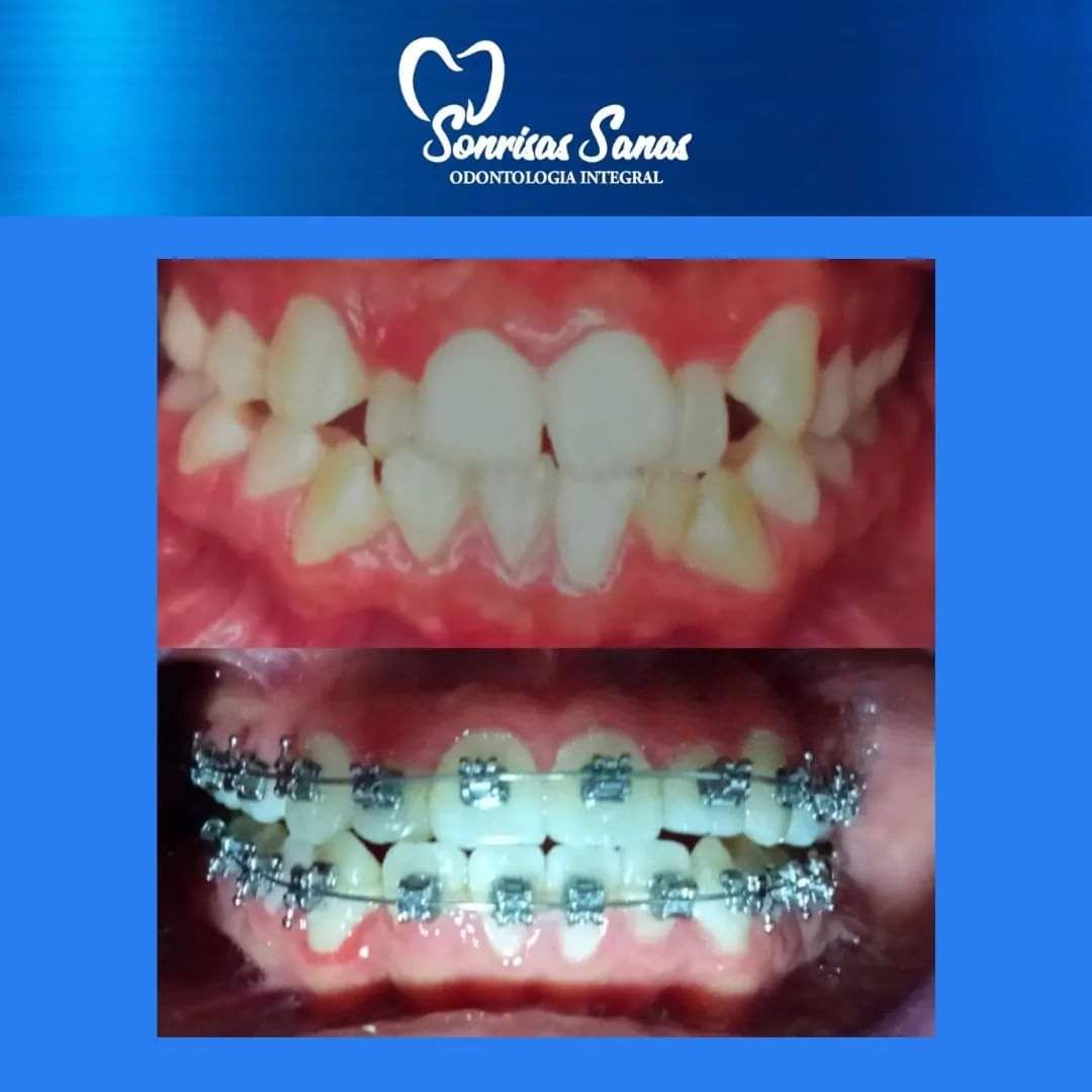 Jacqueline Nuñez Herrera-8