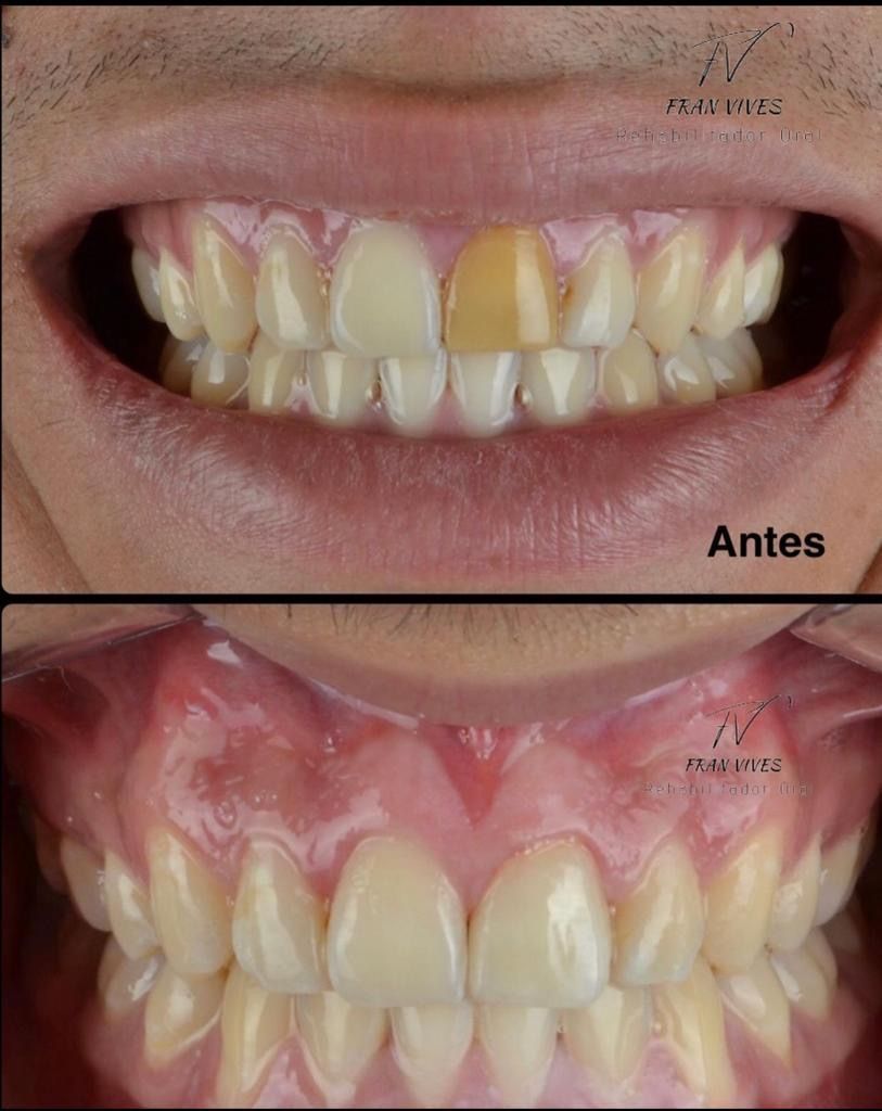 Francisco Jose Vives Serrano-29