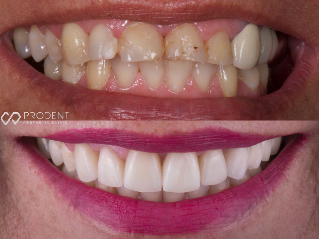 Ramiro Ivan Pérez Murillo-9