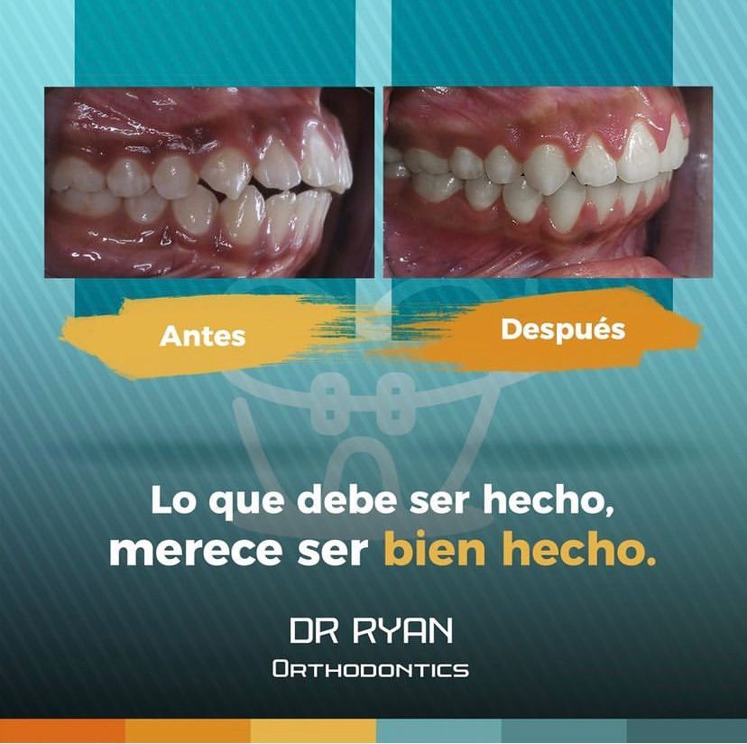 Ryan Michael Brenes Pacheco-3