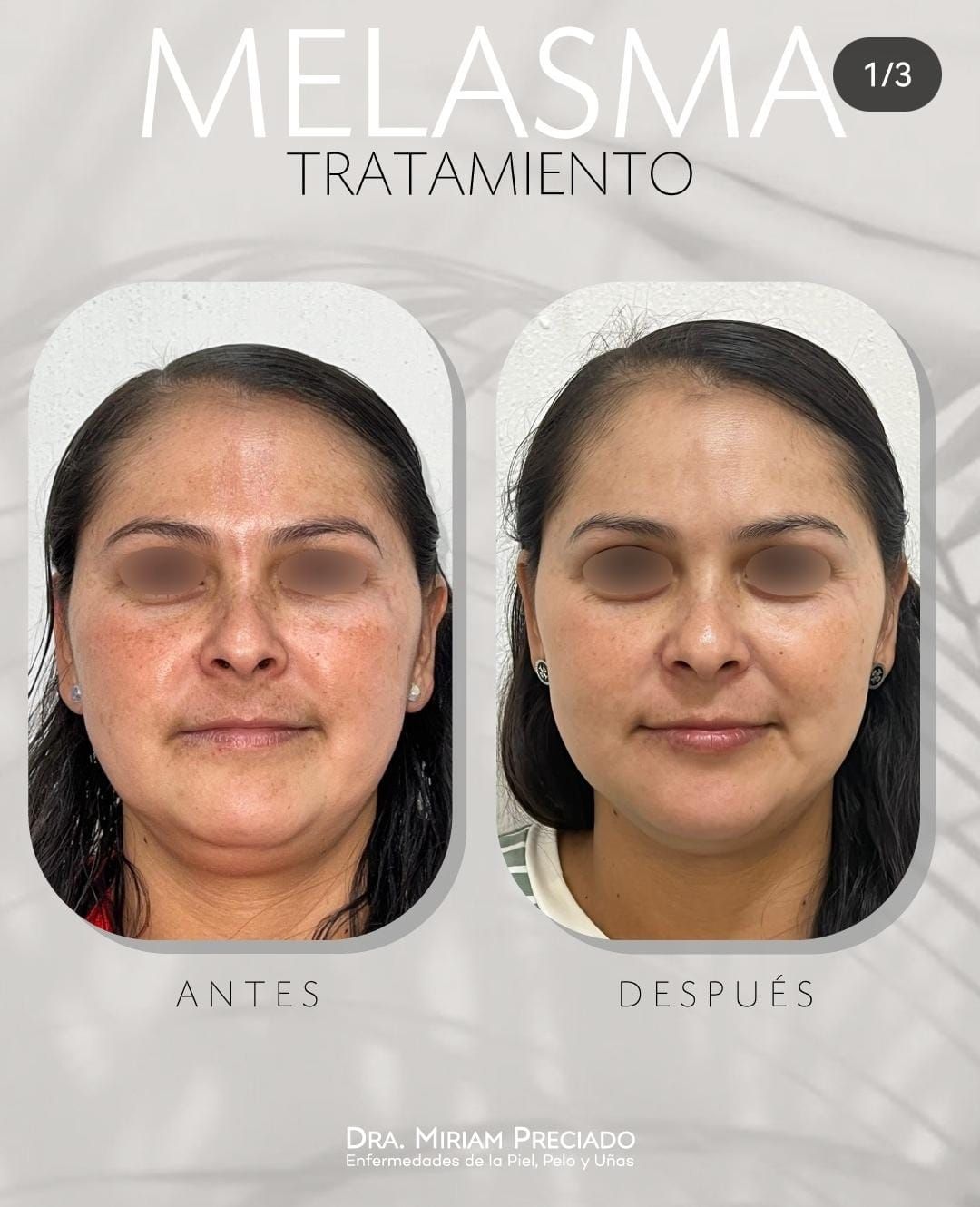 Miriam Sarahi Preciado Aguiar-1