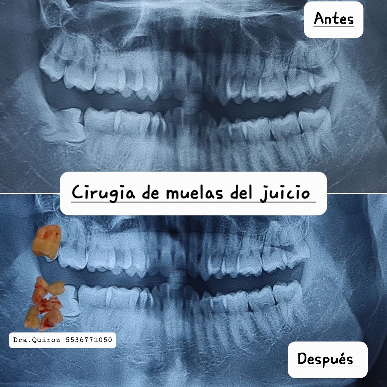 Aimée Quiroz Mendoza-68