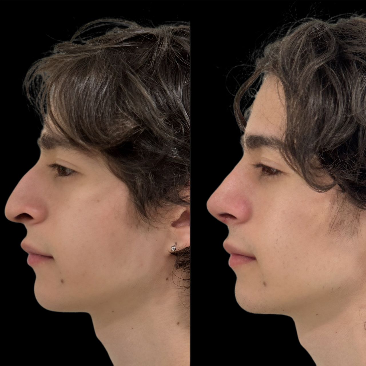 Ramiro Chávez Montoya-7