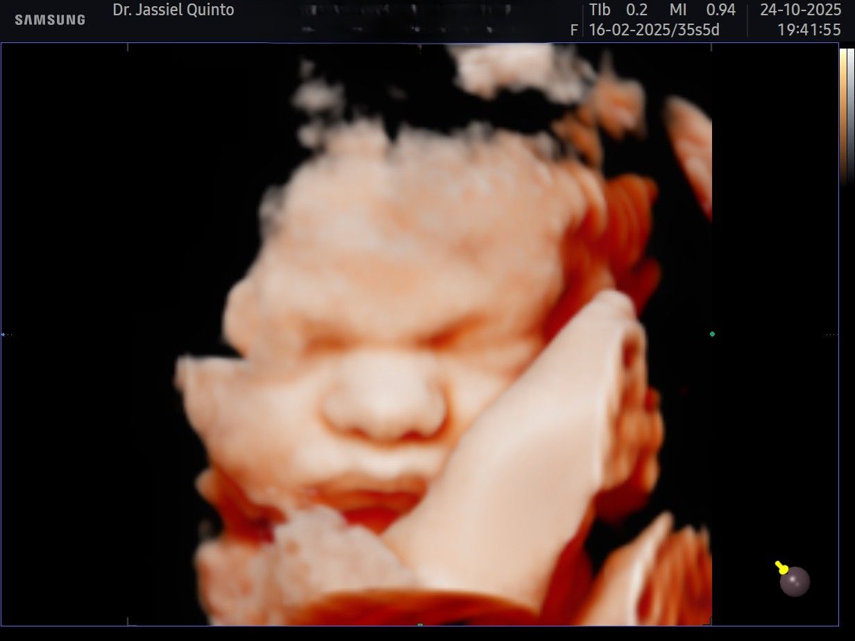 Jose Jassiel Quinto Gonzalez-0