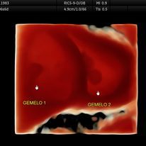Rodolfo Higareda Sanchez-11
