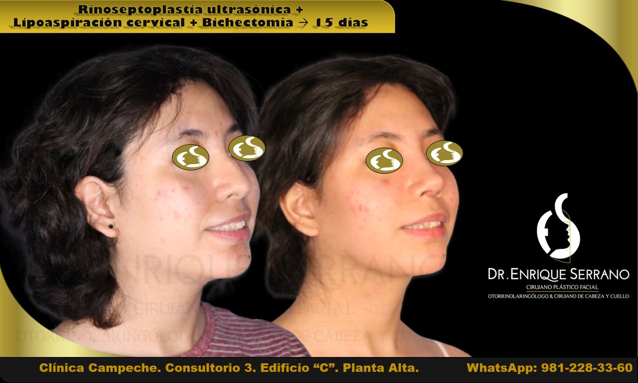 Enrique Serrano Cruz-20