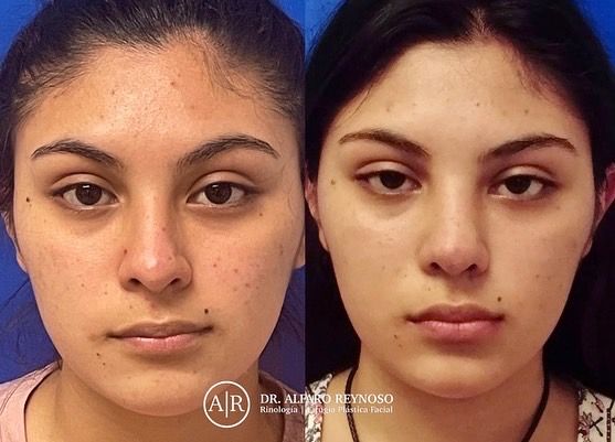 Jose Alberto Alfaro Reynoso-10