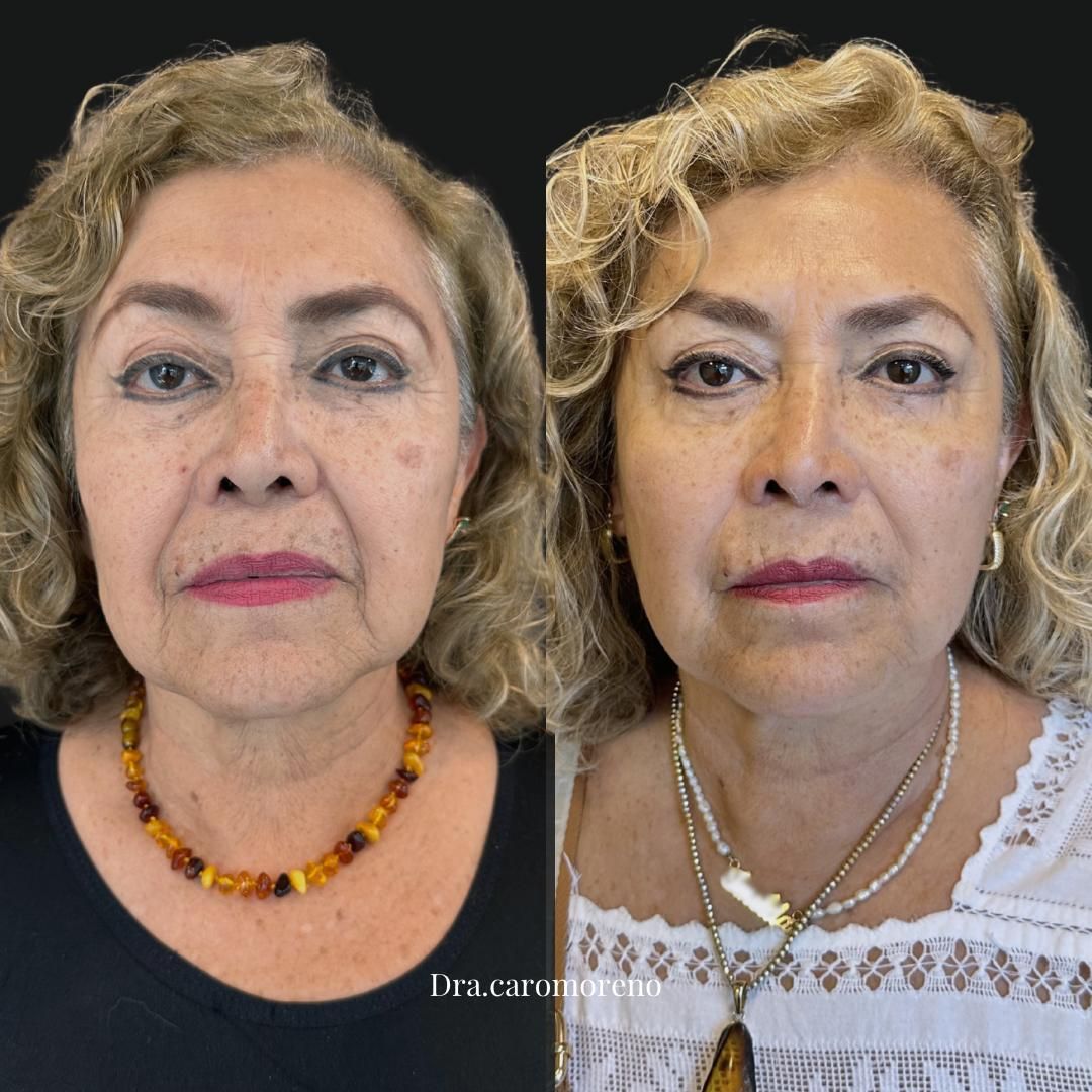 Carolina Moreno-1