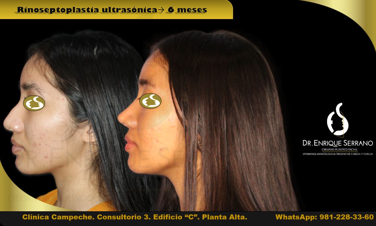 Enrique Serrano Cruz-30