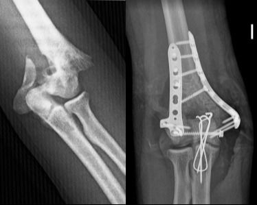 Luis Castañón Robles-26