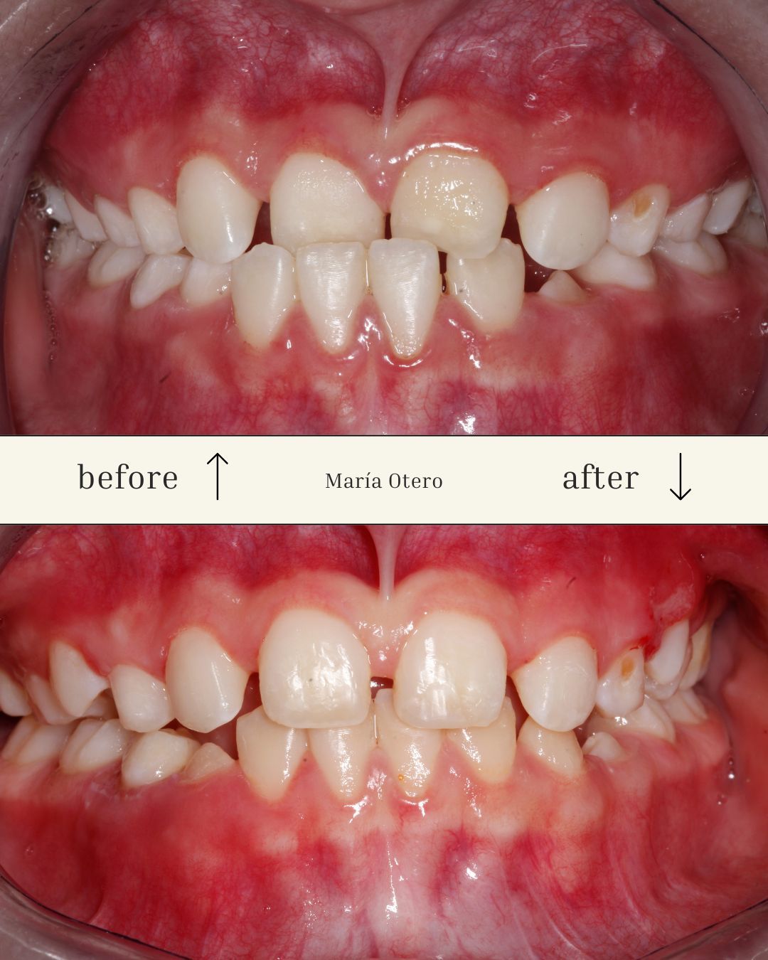 Maria Jesus Otero Lois-0