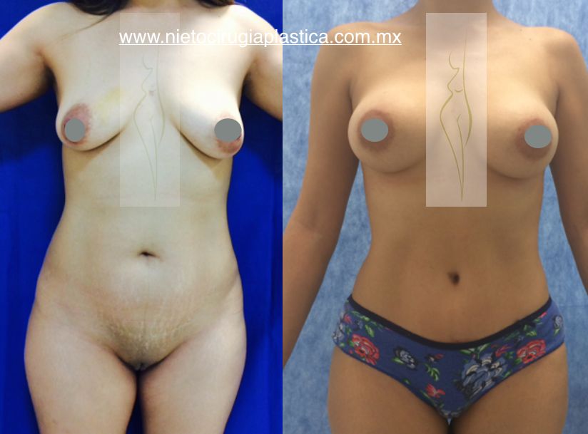 Rubén Nieto Balcázar-2