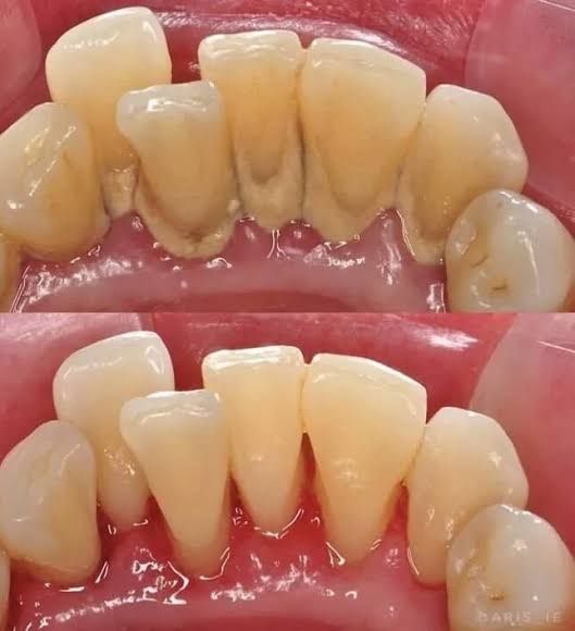 Alejandro Angelo López Díaz-3