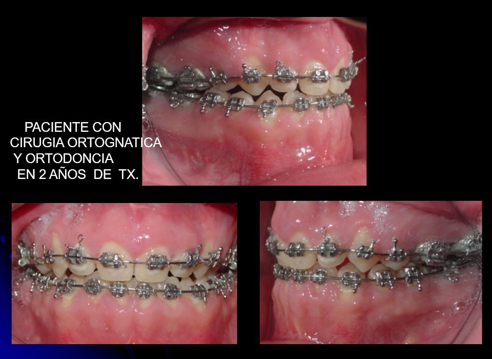 Victor Hugo Sepulveda Núñez-1