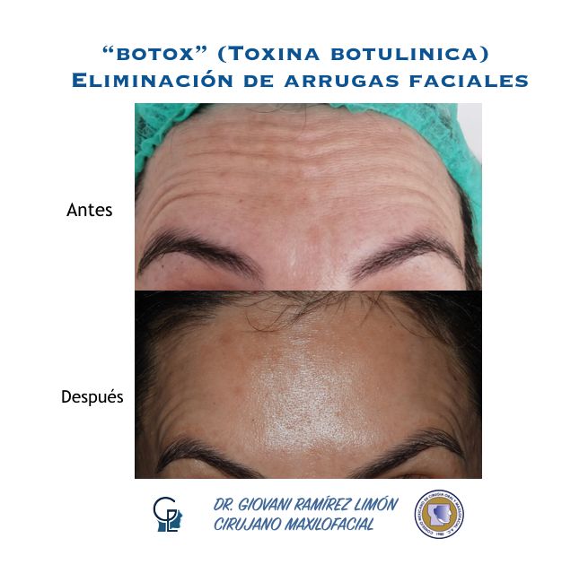 Giovani Ramírez Limón-48