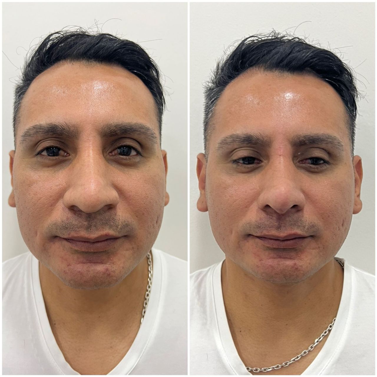 Juan Herrera Hernández-28