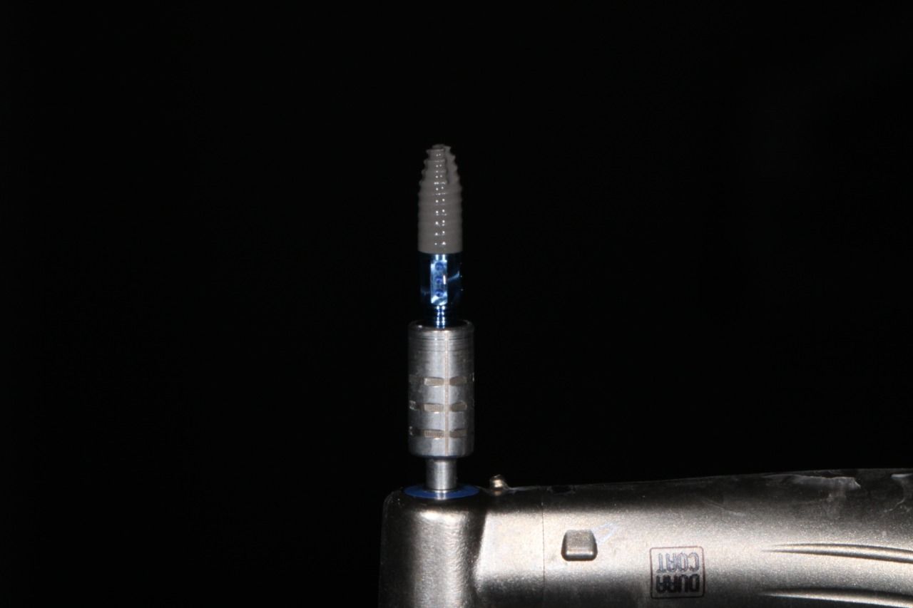 Luis Alonso Flores Reyna-4