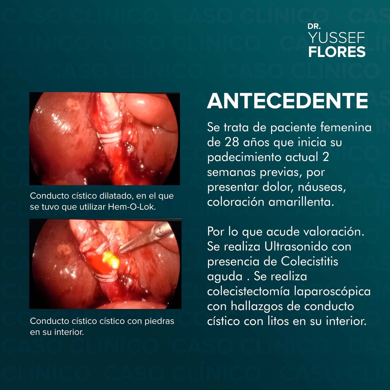 Yussef Flores López-7