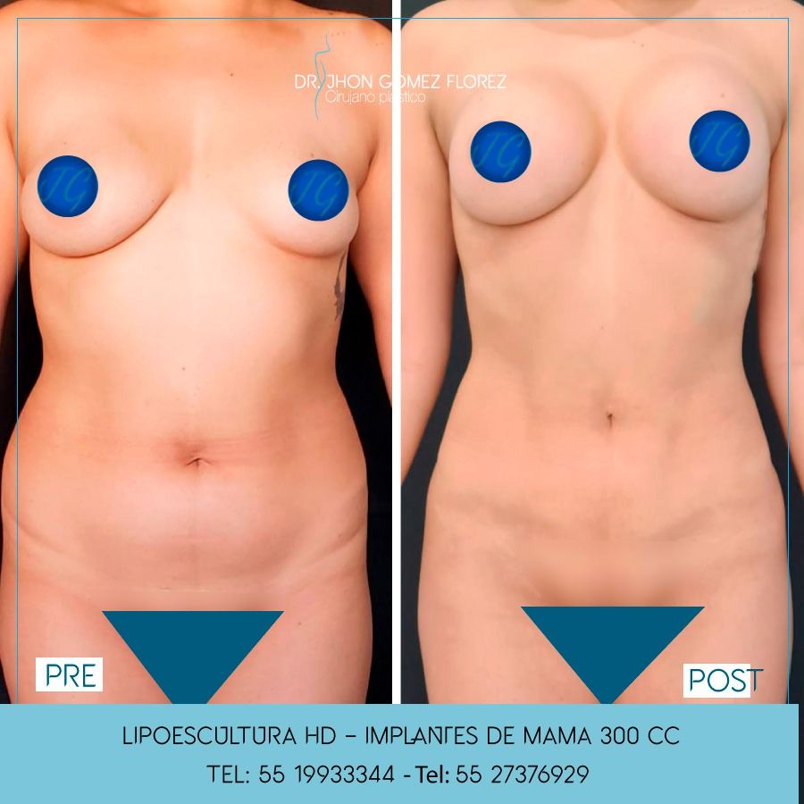 Jhon César Gómez Florez-25